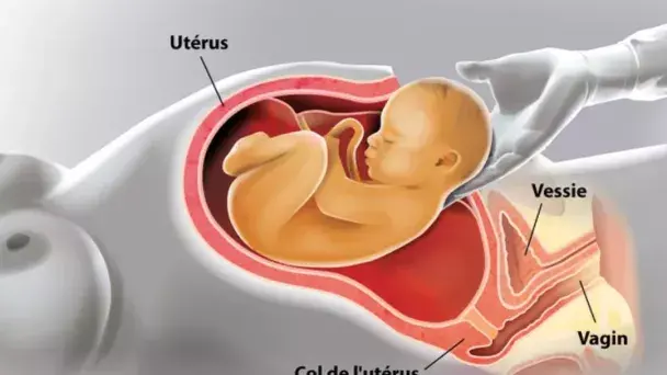 Accouchement par voie basse