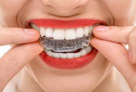 Centre invisalign casablanca