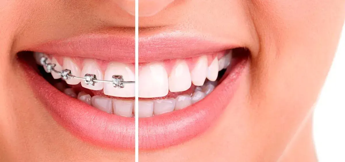 Orthodontiste casablanca
